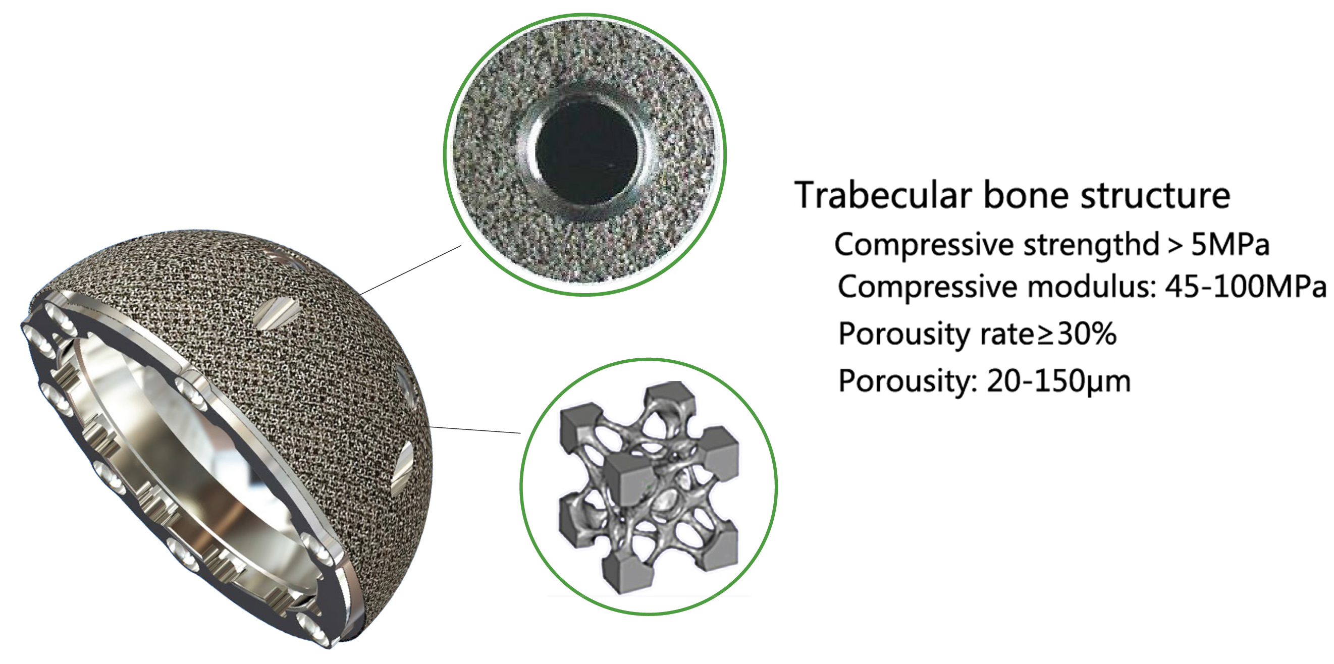SEE® Trabecular Acetabular Cup System