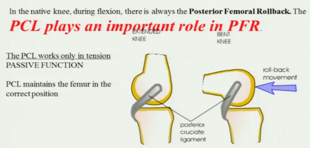 Advantages and disadvantages of CR knee joint prosthesis