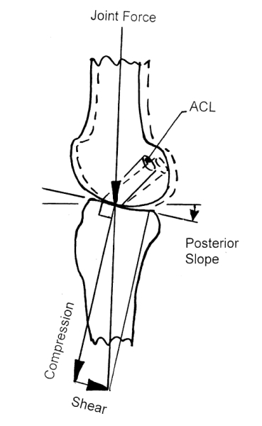 Knee Joint Figure 1