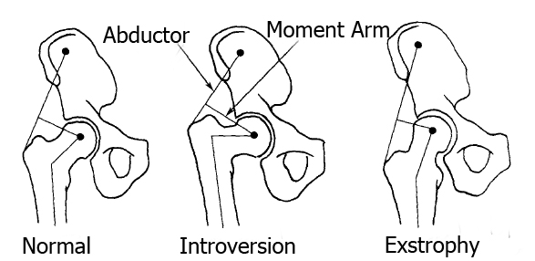 Hip Joint Mechanics Analysis
