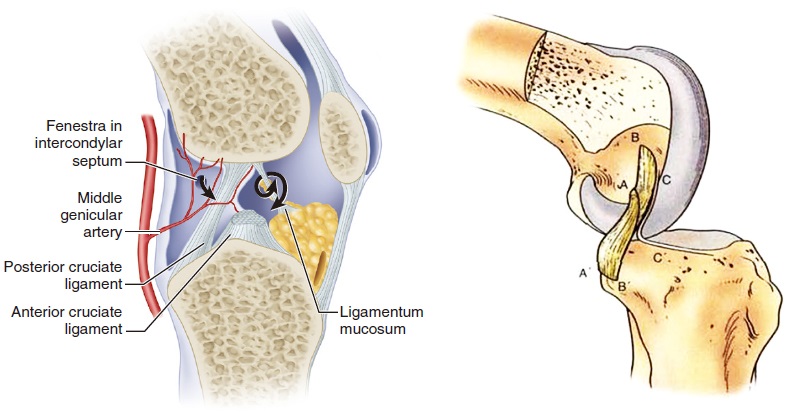 Posterior cruciate ligament retaining (CR) TKA