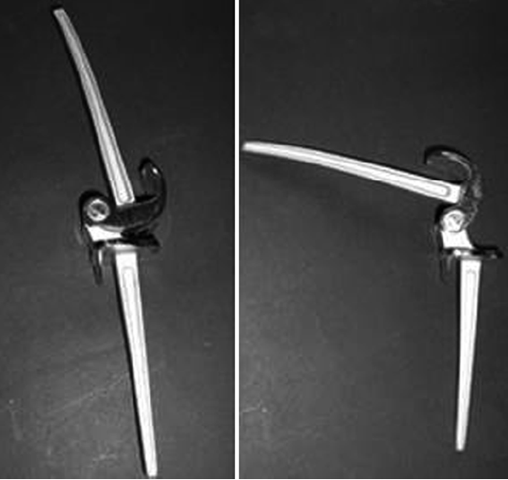 Rotating hinge: a simple and effective solution for complex knee arthroplasty