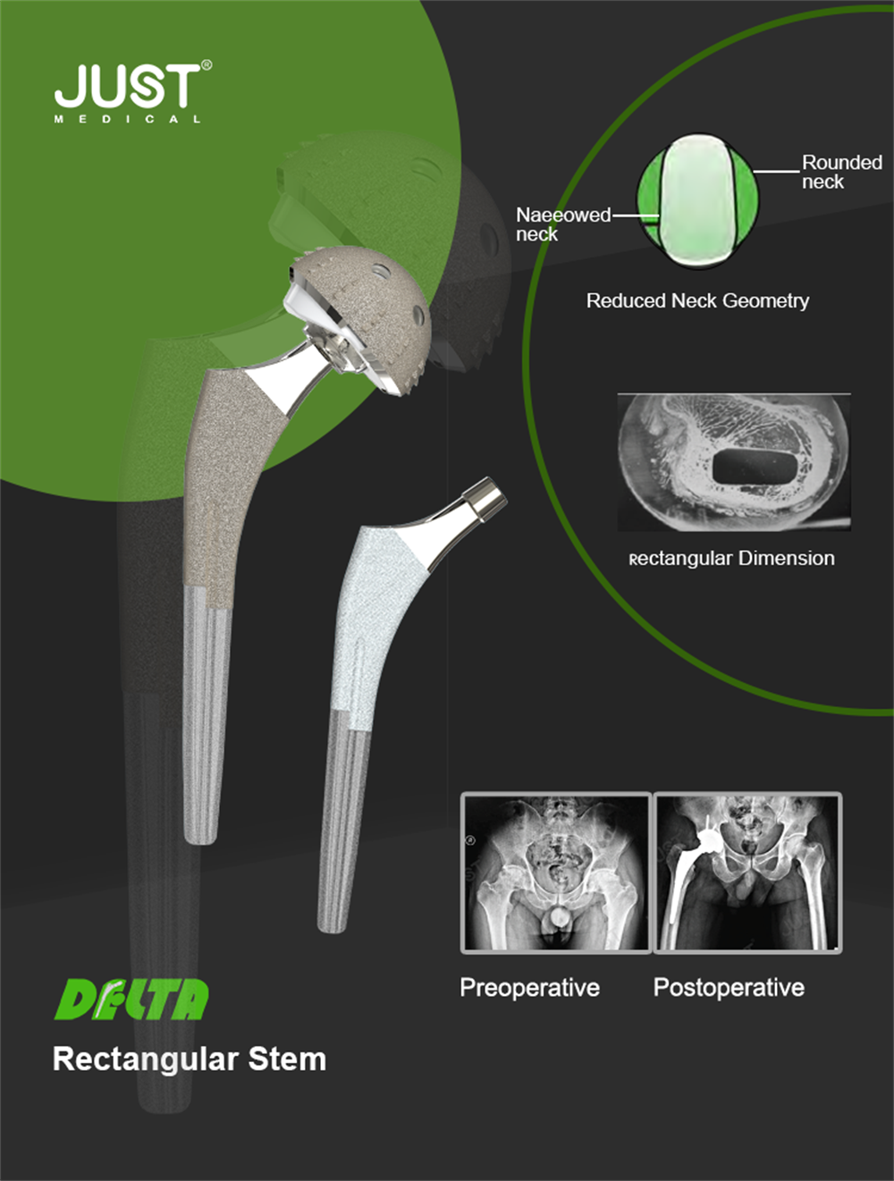 Delta Hip Joint System
