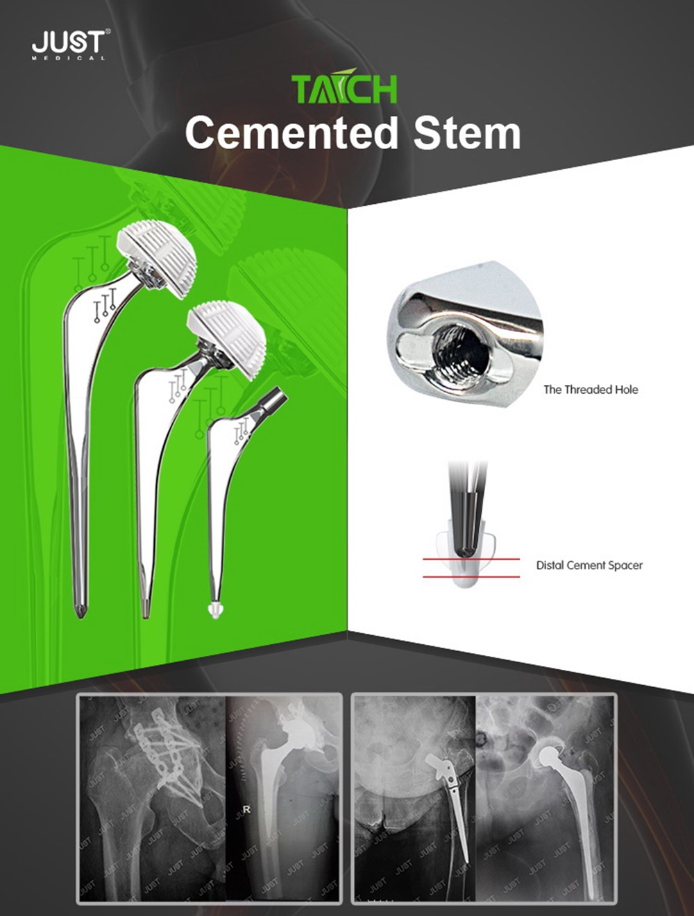 TAICH LONG femoral stem Hip Joint System