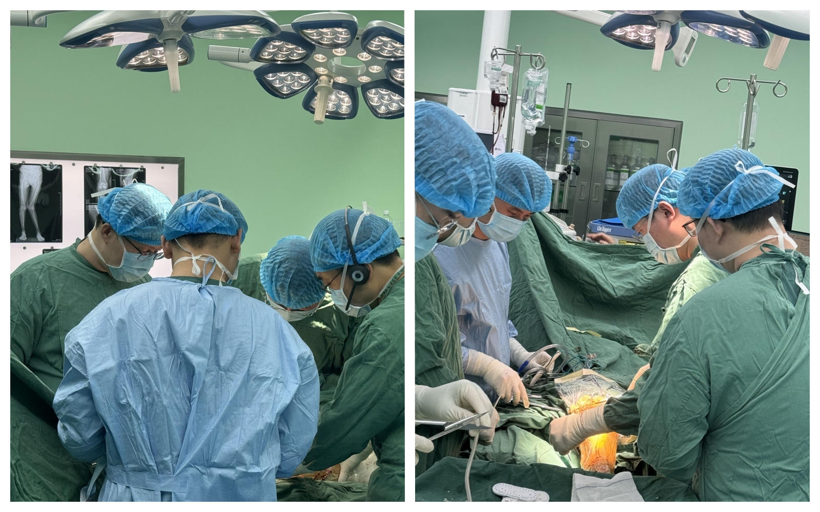 Jointly hosted by JUST Medical and Zhengzhou Orthopedic Hospital, the "Belt and Road Initiatives" Live Surgery was a complete success.