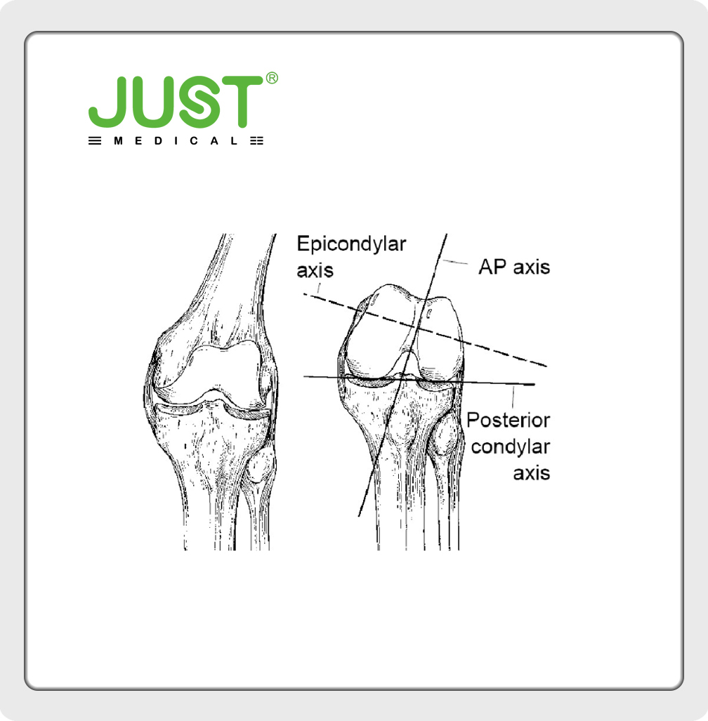 Bone structure of knee joint-femur